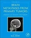 Brain Metastases from Primary Tumors, Volume 2