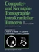 Computer- und Kernspin-Tomographie intrakranieller Tumoren aus klinischer Sicht